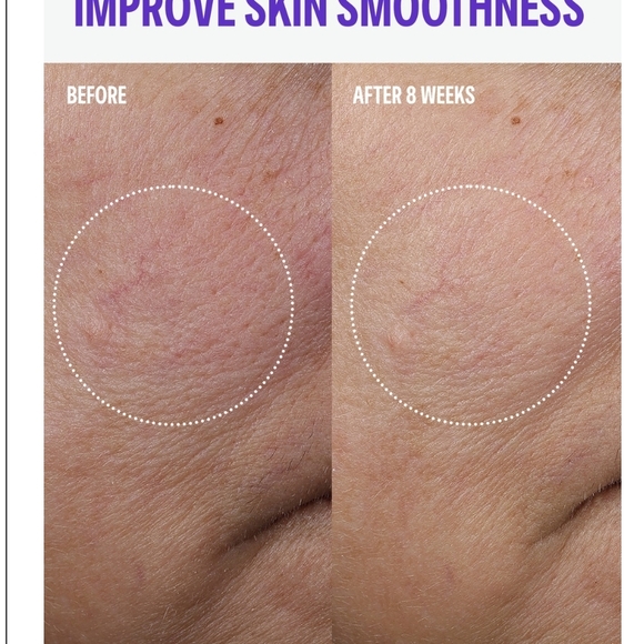 Paula's Choice Cellular Youth Longevity Serum with White and Black Packaging - Picture 4 of 6